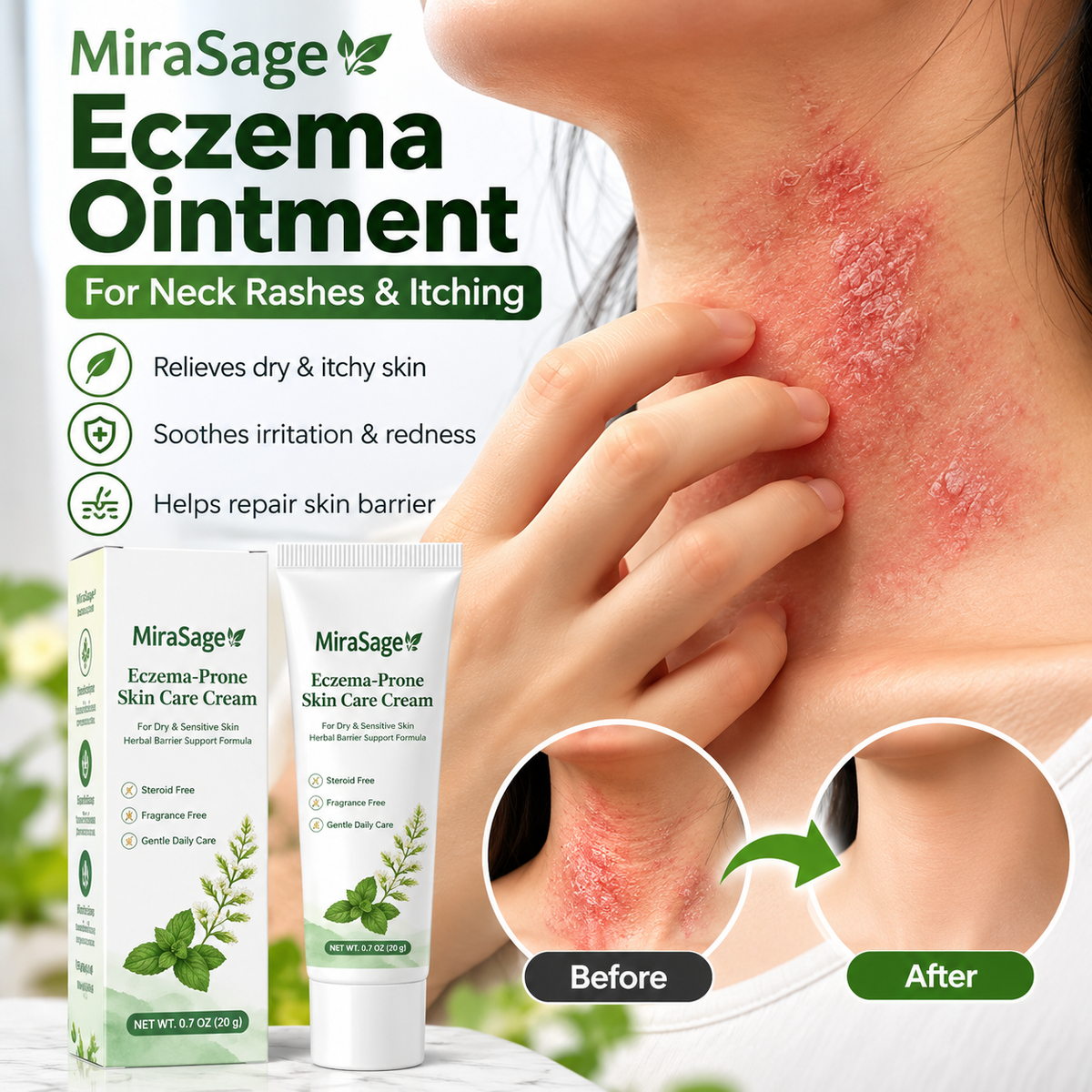 Eczema Prone Skin Care Cream