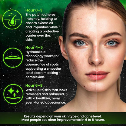 Glow In Dark Pimple Patches