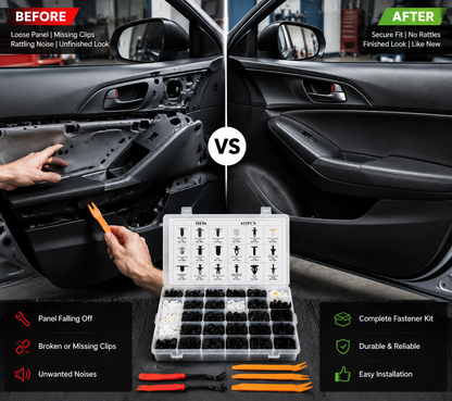 Car Fastener Box Set